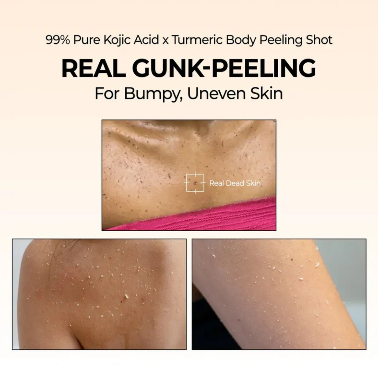 Kojic Acid Turmeric Body Peel Spray™