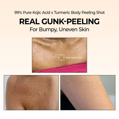 Kojic Acid Turmeric Body Peel Spray™