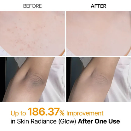 Kojic Acid Turmeric Body Peel Spray™