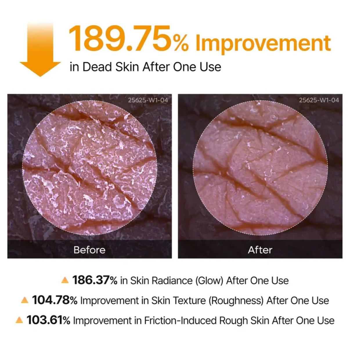Kojic Acid Turmeric Body Peel Spray™
