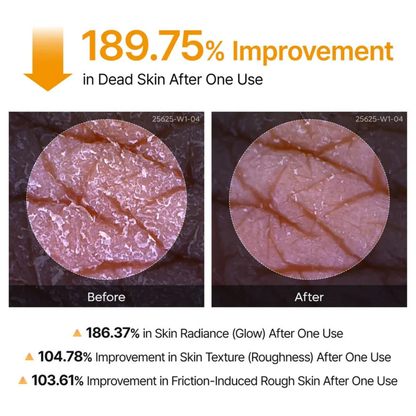 Kojic Acid Turmeric Body Peel Spray™