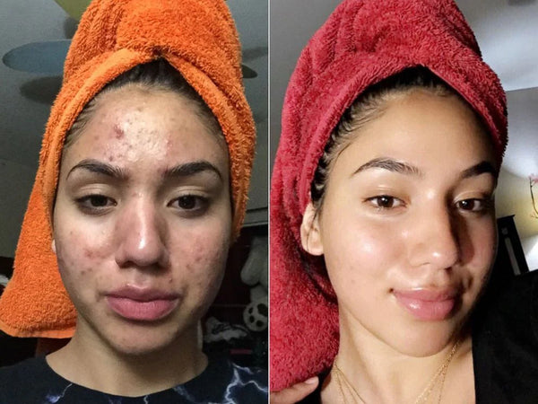 Real Skin, Real Results...