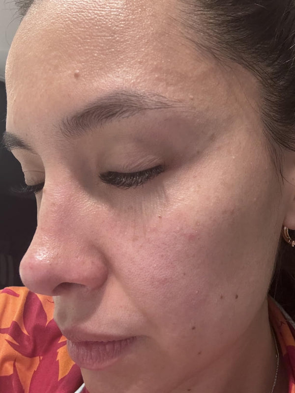 Real Skin, Real Results...