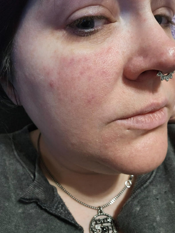 Real Skin, Real Results...